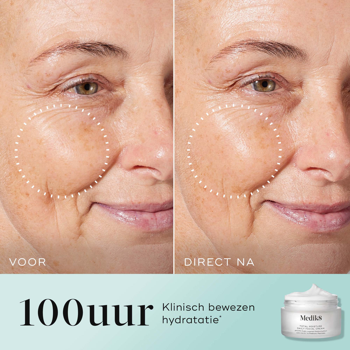 Total Moisture Daily Facial Cream™ Refill