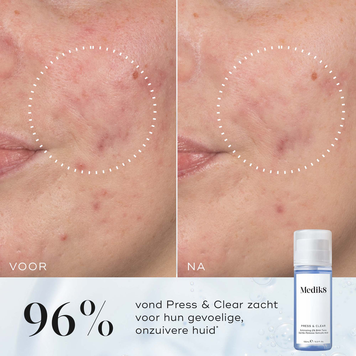 Medik8 Press & Claer toner